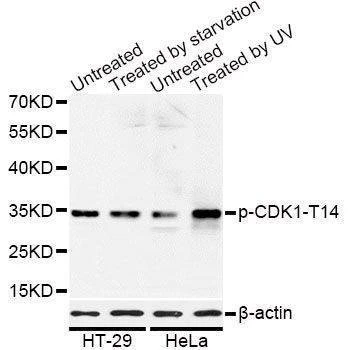 Anti-Phospho-CDK1-T14 Antibody