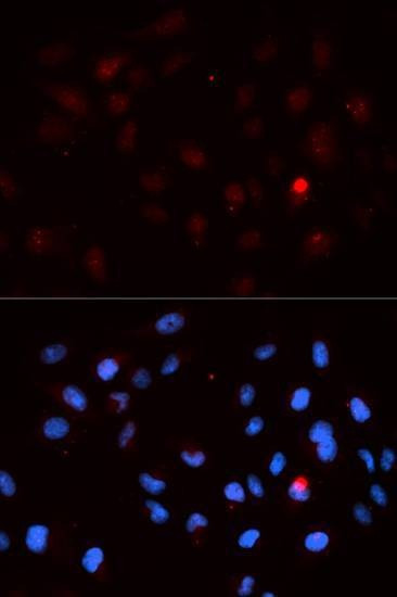 Anti-Phospho-CDK1-T14 Antibody