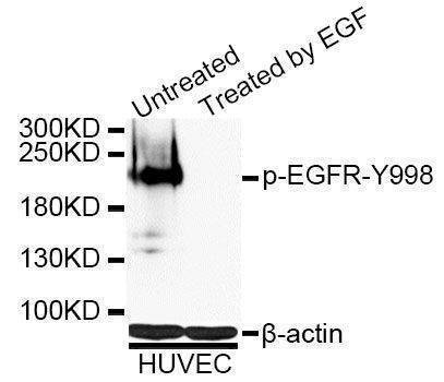 Anti-Phospho-EGFR-Y998 Antibody