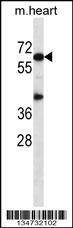 Anti-Mouse Akt1 (N-term) Antibody