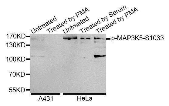 Anti-Phospho-MAP3K5-S1033 Antibody