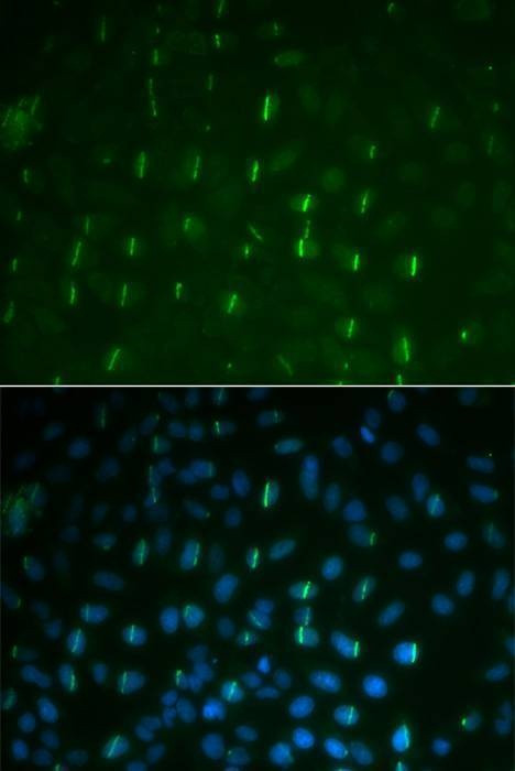 Anti-Phospho-H2AFX-S139 Antibody