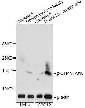 Anti-Phospho-STMN1-S16 Antibody