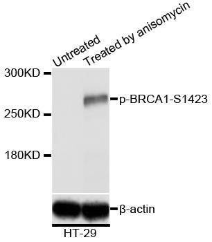 Anti-Phospho-BRCA1-S1423 Antibody