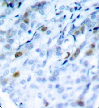Anti-Phospho-CDK1-T161 Antibody