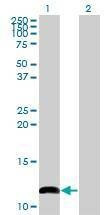 Anti-COX6B1 Antibody