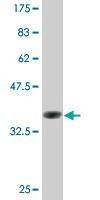 Anti-COX6B1 Antibody