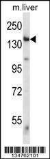 Anti-Mouse Eif2ak4 (C-term) Antibody