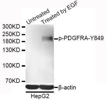 Anti-Phospho-PDGFRA-Y849 Antibody