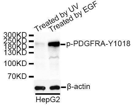 Anti-Phospho-PDGFRA-Y1018 Antibody