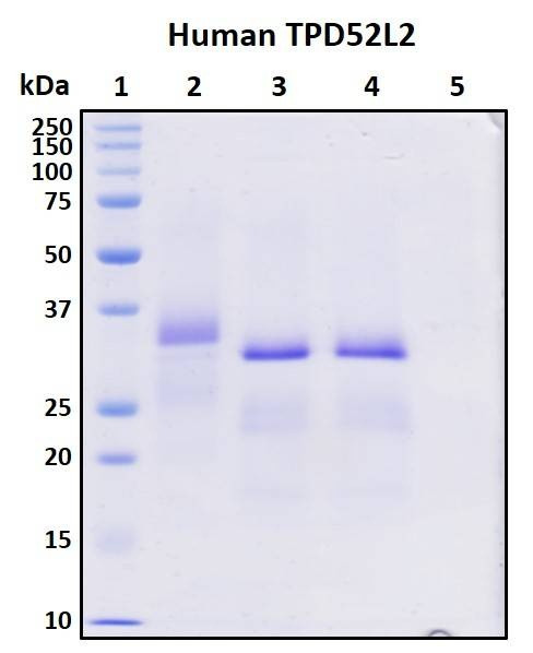 Recombinant Human TPD52L2 Protein