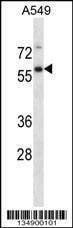 Anti-USP30 (N-term) Antibody