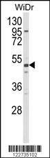 Anti-ALDH5A1 Antibody