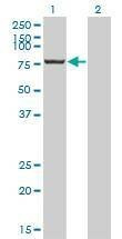 Anti-CPSF3 Antibody