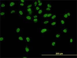 Anti-CPSF3 Antibody