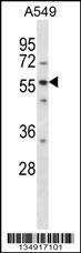 Anti-LSM14A (C-term) Antibody