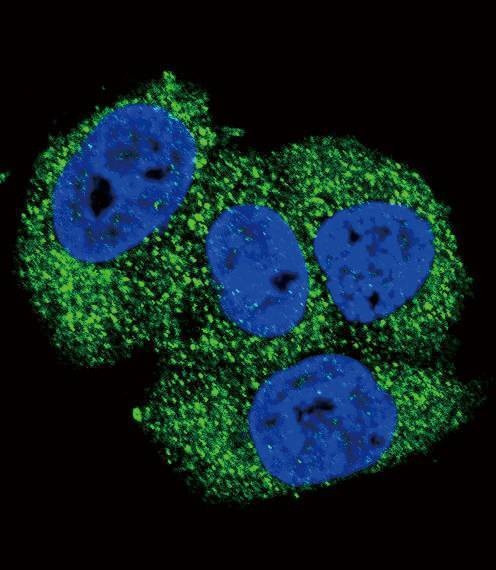 Anti-ALPL (Center) Antibody
