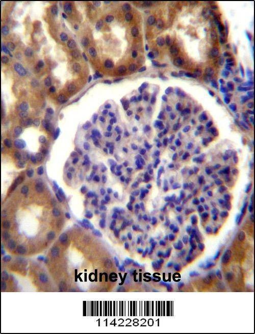 Anti-ALPL (Center) Antibody