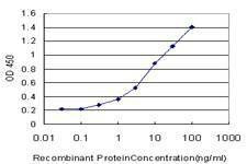Anti-CPT2 Antibody