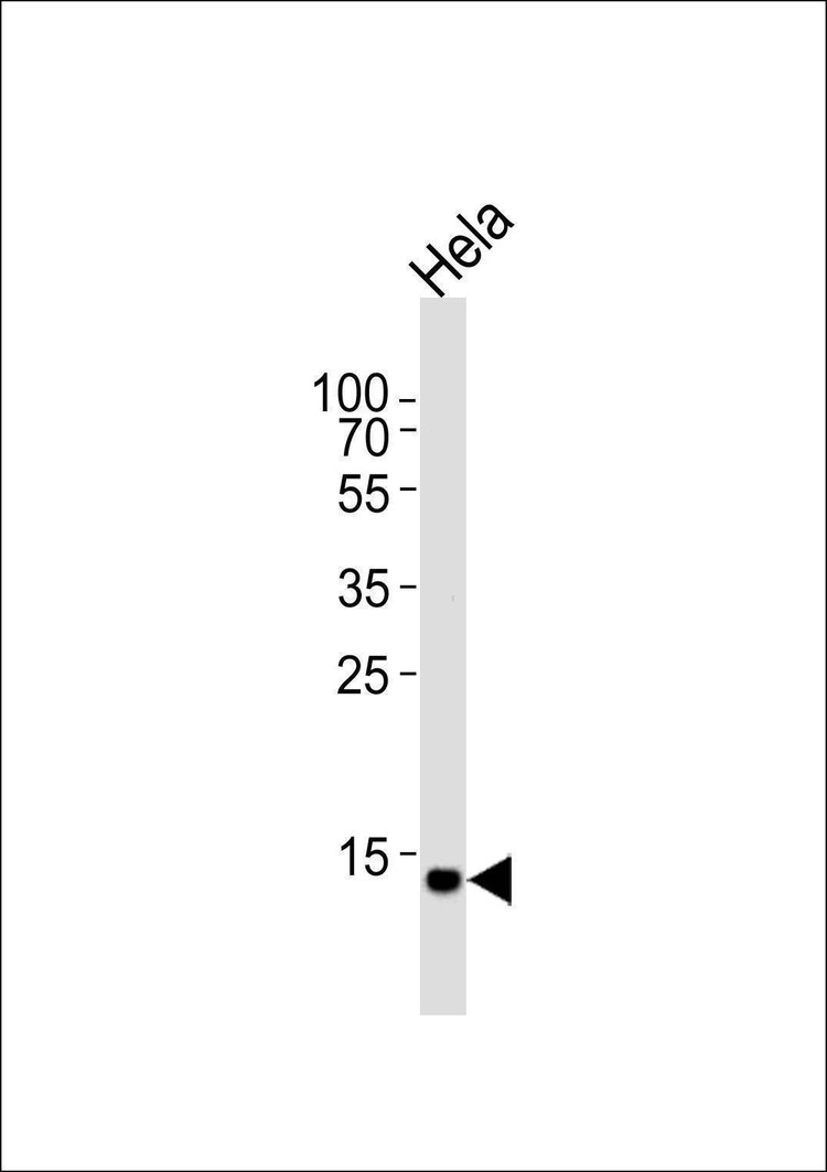 Anti-UBE2D2 (C-term) Antibody