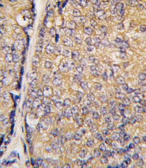 Anti-BRDG 1 (N-term F56) Antibody
