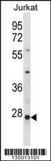 Anti-HTATIP2 (N-term) Antibody