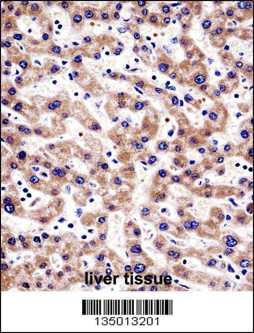 Anti-HTATIP2 (N-term) Antibody