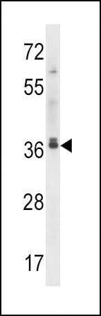 Anti-MAPRE2 (N-term) Antibody