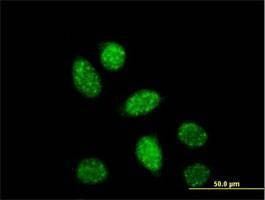 Anti-CREB1 Antibody