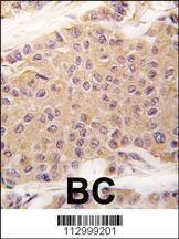 Anti-TGF Beta 2 (C-term) Antibody