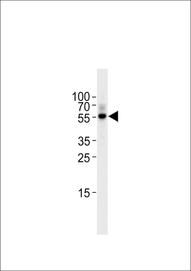 Anti-TGF Beta 2 (C-term) Antibody