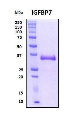 Recombinant Human IGFBP-7 Protein, HEK293