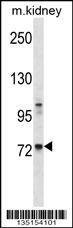 Anti-Mouse Tec (Center) Antibody