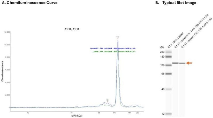 Cell Lysate: Jurkat + PV | Secondary Ab: Rabbit | Exposure: HDR | Expected MW (kDa): 119