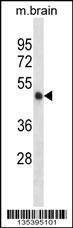 Anti-Mouse Camk2a (C-term) Antibody