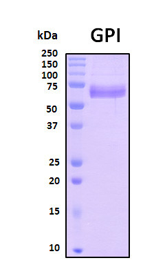 Recombinant Human Glucose-6-phosphate isomerase/GPI Protein