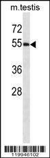 Anti-Mouse WWOX (C-term) Antibody