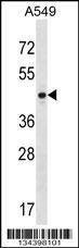 Anti-PTX3 (Center) Antibody