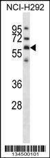 Anti-GPC3 (C-term) Antibody