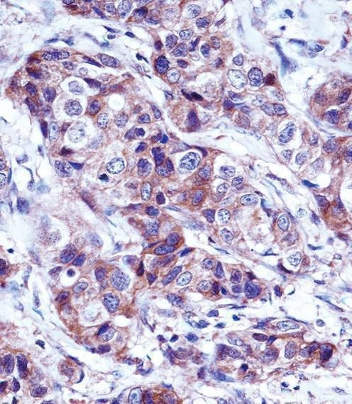 Anti-LALBA (Center) Antibody