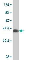 Anti-CREM Antibody