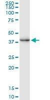 Anti-CREM Antibody