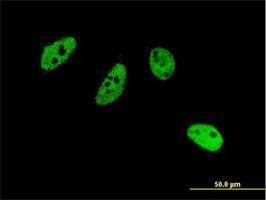 Anti-CREM Antibody