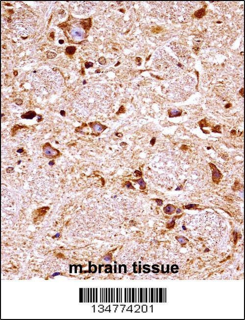 Anti-Fgfr3 (Center) Antibody