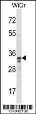 Anti-SPI1 (C-term) Antibody