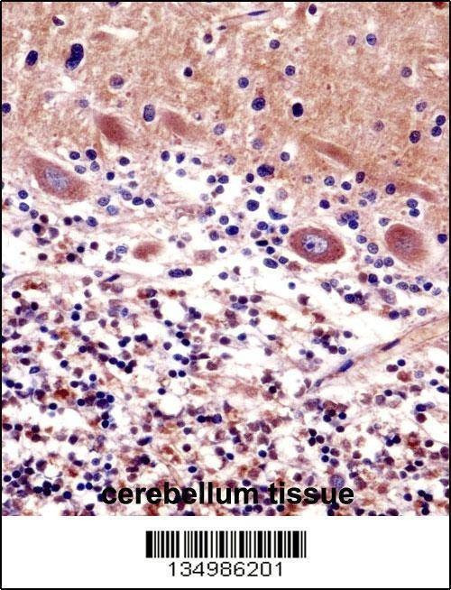 Anti-CDR2 (C-term) Antibody