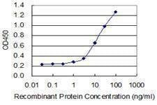 Anti-CRH Antibody