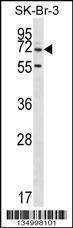 Anti-ZNF398 (Center) Antibody