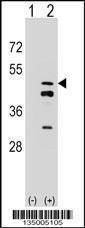 Anti-FDPS (N-term) Antibody