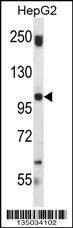 Anti-SND1 (Center) Antibody